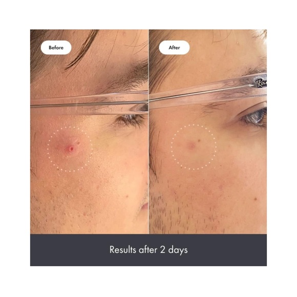 HERO COSMETICS RESCUE BALM POST-BLEMISH RECOVERY CREAM MINI NIP - Picture 4 of 16